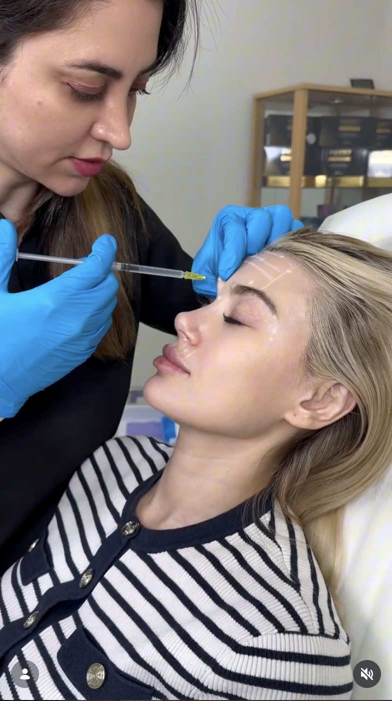 Lip Enhancement